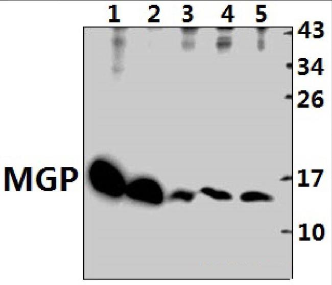 MGP Antibody in Western Blot (WB)