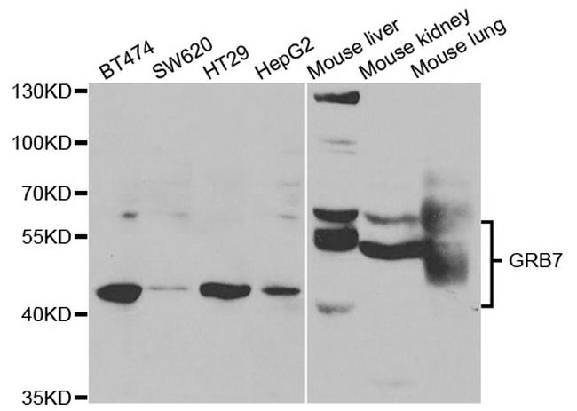 GRB7 Antibody in Western Blot (WB)