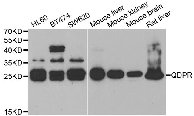 QDPR Antibody in Western Blot (WB)