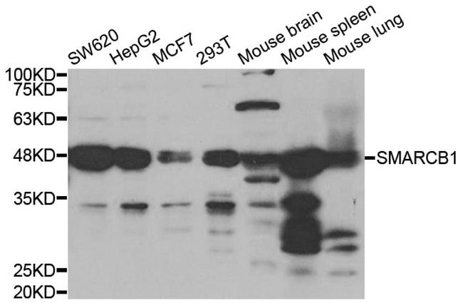 SMARCB1 Antibody in Western Blot (WB)