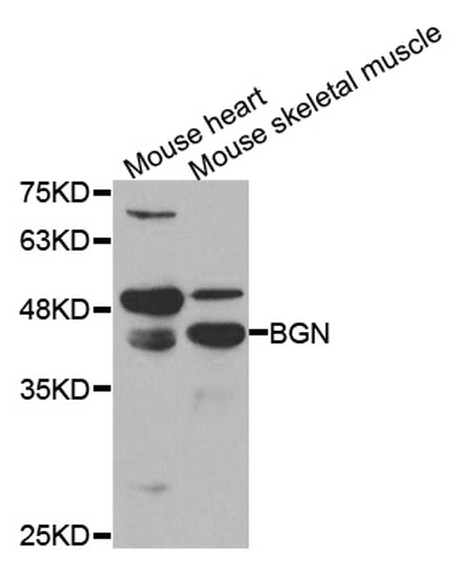 Biglycan Antibody in Western Blot (WB)