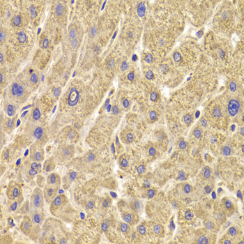 PEX5 Antibody in Immunohistochemistry (Paraffin) (IHC (P))