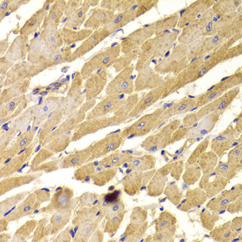 PEX5 Antibody in Immunohistochemistry (Paraffin) (IHC (P))