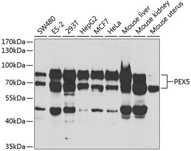 PEX5 Antibody in Western Blot (WB)