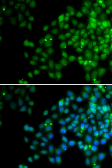 EPC1 Antibody in Immunocytochemistry (ICC/IF)