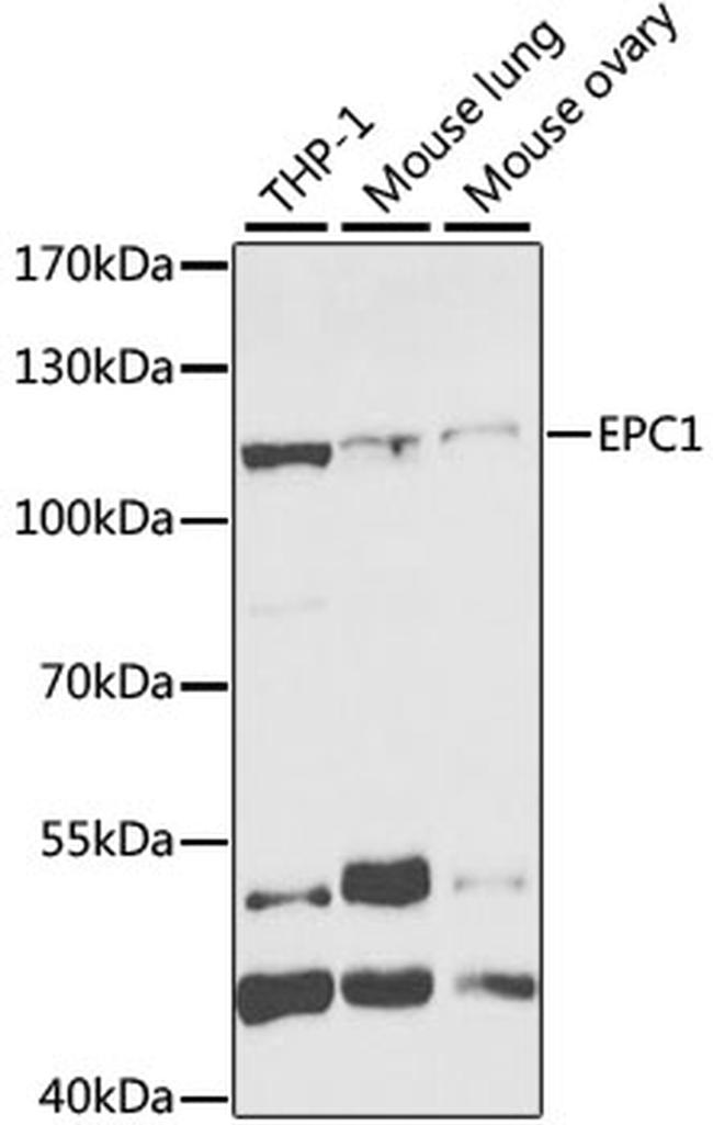 EPC1 Antibody in Western Blot (WB)