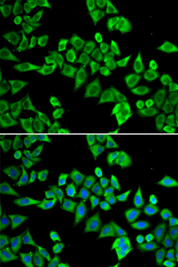 Gemin 3 Antibody in Immunocytochemistry (ICC/IF)