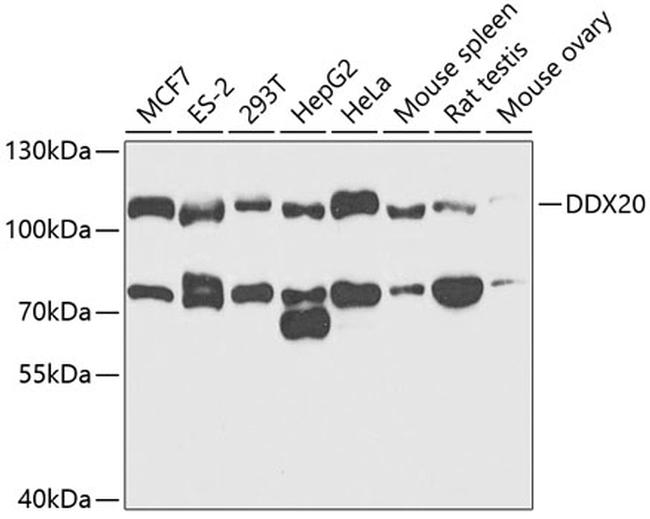 Gemin 3 Antibody in Western Blot (WB)