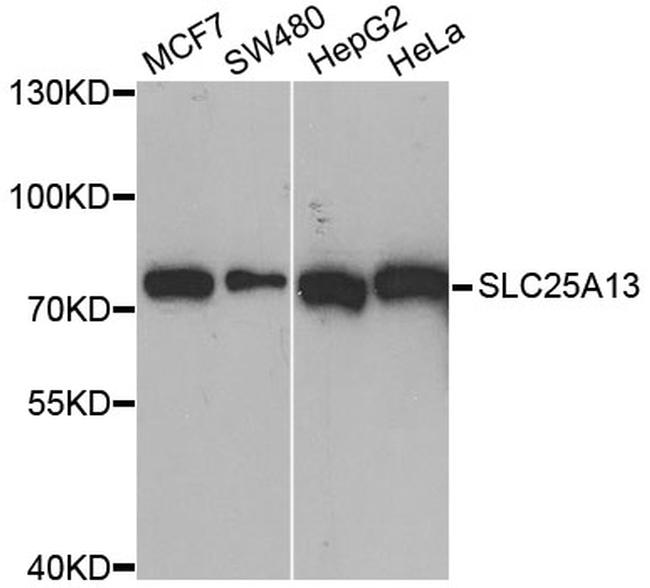 SLC25A13 Antibody in Western Blot (WB)