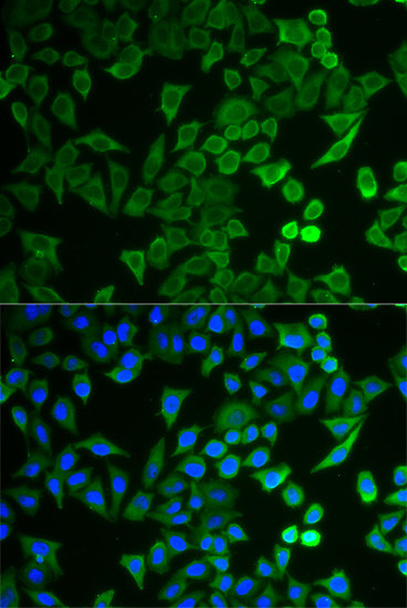 NPRL2 Antibody in Immunocytochemistry (ICC/IF)