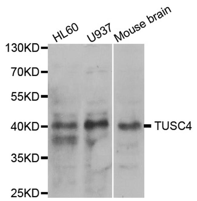 NPRL2 Antibody in Western Blot (WB)