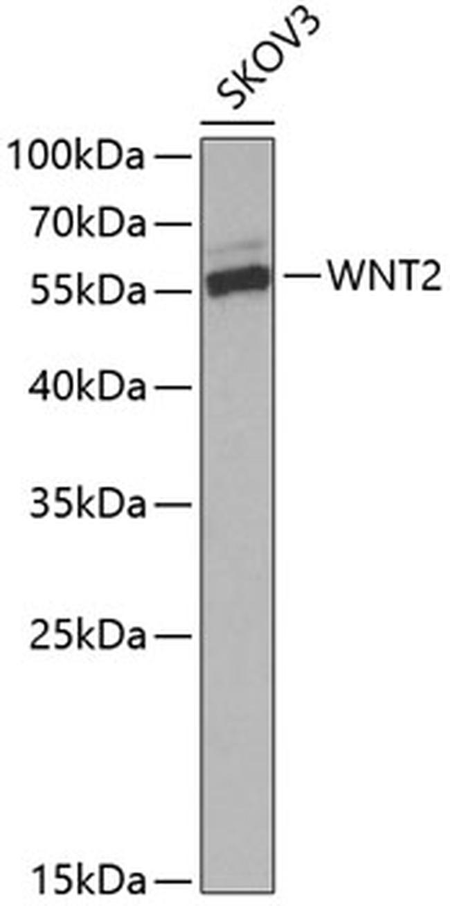 WNT2 Antibody in Western Blot (WB)