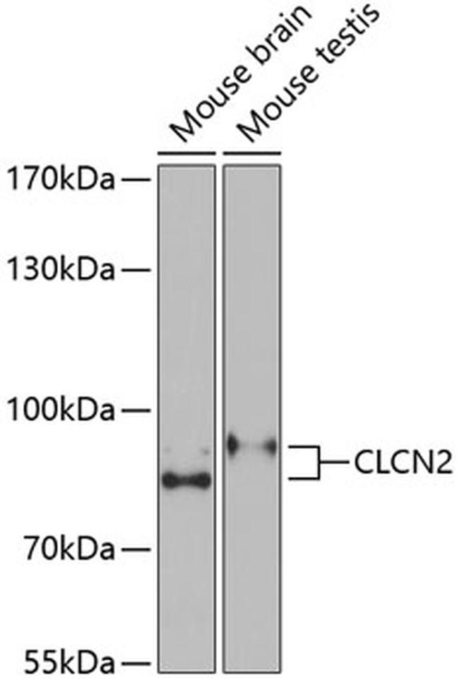 CLCN2 Antibody in Western Blot (WB)