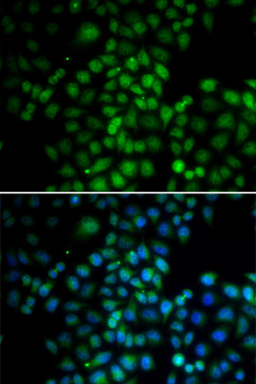 C11orf30 Antibody in Immunocytochemistry (ICC/IF)