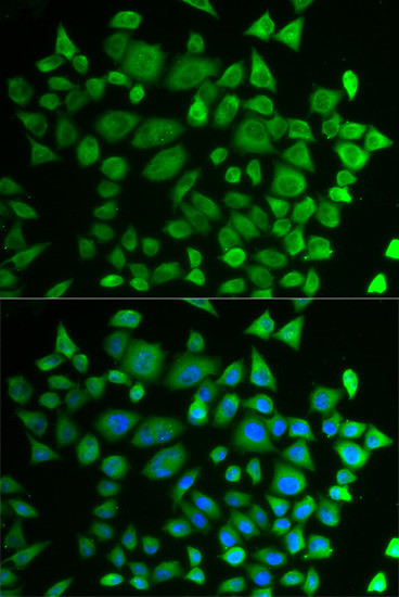 P4HTM Antibody in Immunocytochemistry (ICC/IF)