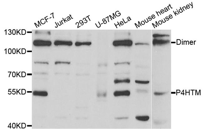 P4HTM Antibody in Western Blot (WB)