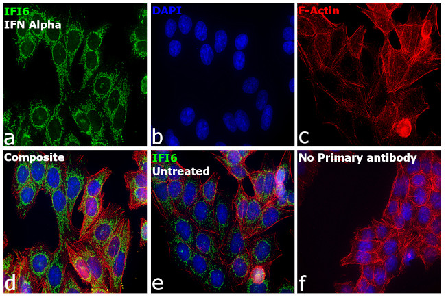 IFI6 Antibody in Immunocytochemistry (ICC/IF)