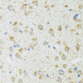 COG2 Antibody in Immunohistochemistry (Paraffin) (IHC (P))