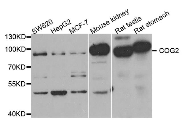 COG2 Antibody in Western Blot (WB)
