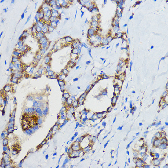 CYP51A1 Antibody in Immunohistochemistry (Paraffin) (IHC (P))