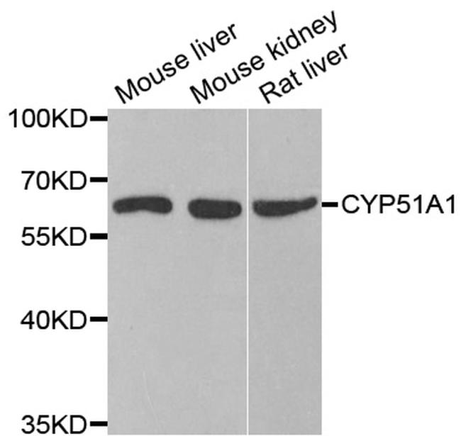 CYP51A1 Antibody in Western Blot (WB)