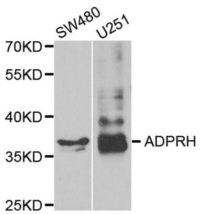 ADPRH Antibody in Western Blot (WB)