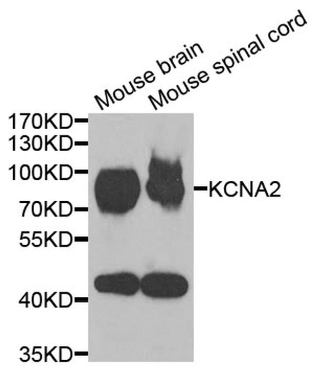 KV1.2 (KCNA2) Antibody in Western Blot (WB)