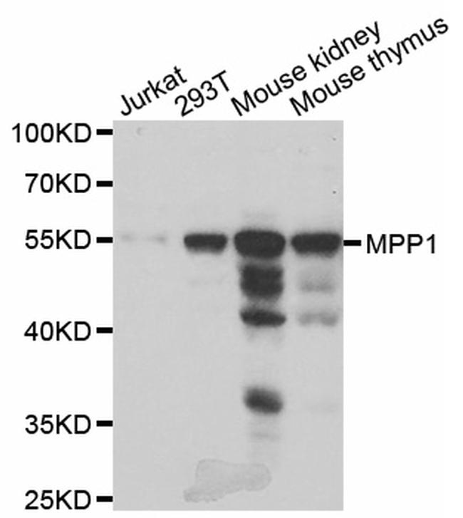 MPP1 Antibody in Western Blot (WB)