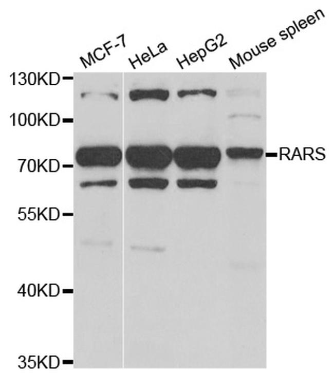 RARS Antibody in Western Blot (WB)