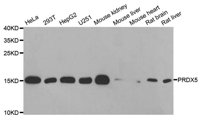 PRDX5 Antibody in Western Blot (WB)