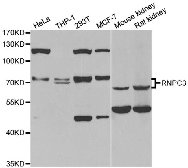 RNPC3 Antibody in Western Blot (WB)