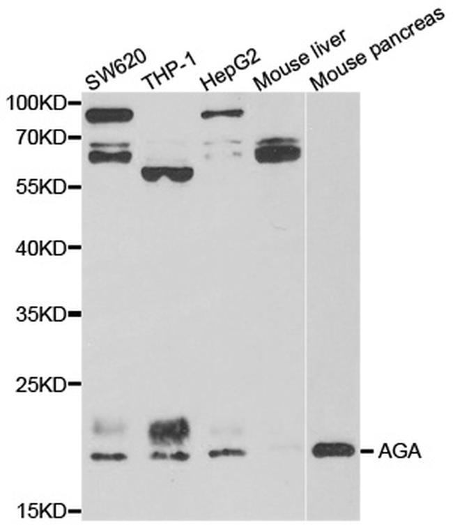 AGA Antibody in Western Blot (WB)