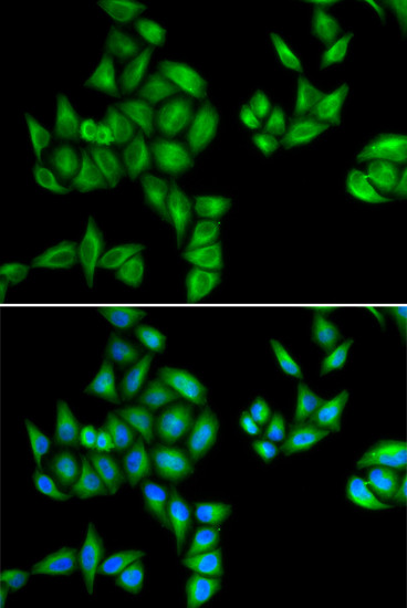 BTG1 Antibody in Immunocytochemistry (ICC/IF)