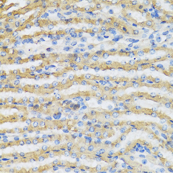 C4BPB Antibody in Immunohistochemistry (Paraffin) (IHC (P))