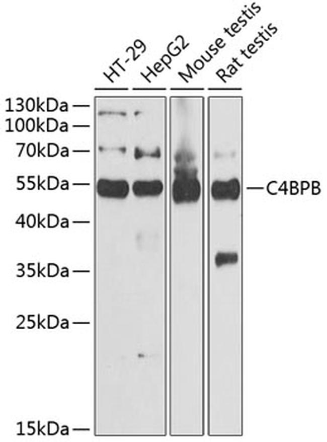 C4BPB Antibody in Western Blot (WB)