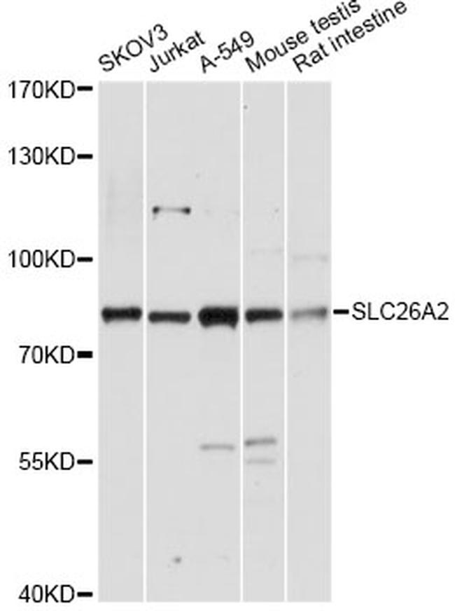 SLC26A2 Antibody in Western Blot (WB)