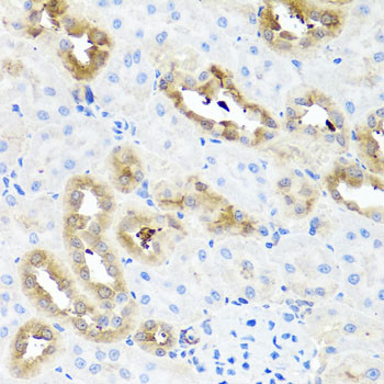 FABP5 Antibody in Immunohistochemistry (Paraffin) (IHC (P))