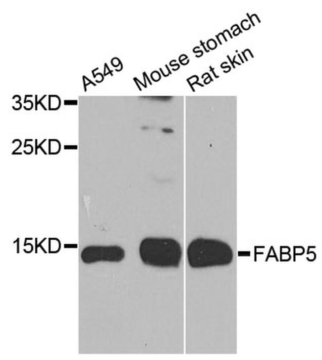 FABP5 Antibody in Western Blot (WB)