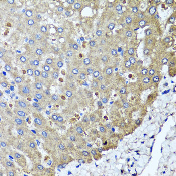 PPOX Antibody in Immunohistochemistry (Paraffin) (IHC (P))