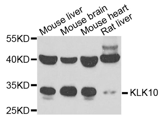 Kallikrein 10 Antibody in Western Blot (WB)