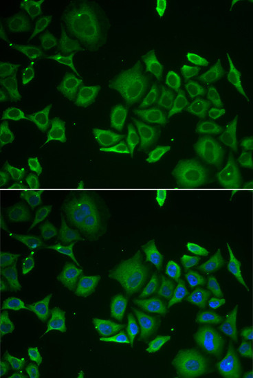 C1D Antibody in Immunocytochemistry (ICC/IF)