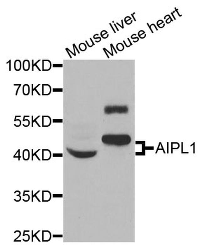 AIPL1 Antibody in Western Blot (WB)