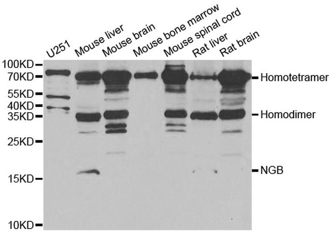 NGB Antibody in Western Blot (WB)