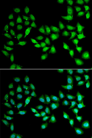 UCN2 Antibody in Immunocytochemistry (ICC/IF)