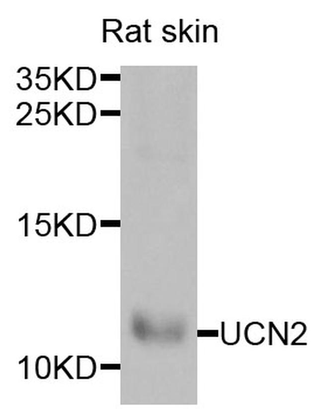 UCN2 Antibody in Western Blot (WB)