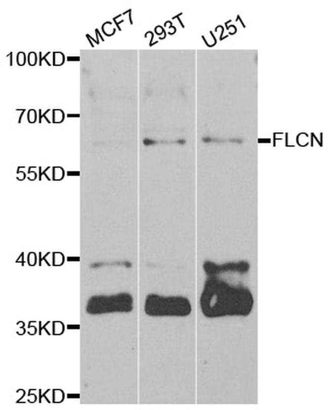 Folliculin Antibody in Western Blot (WB)