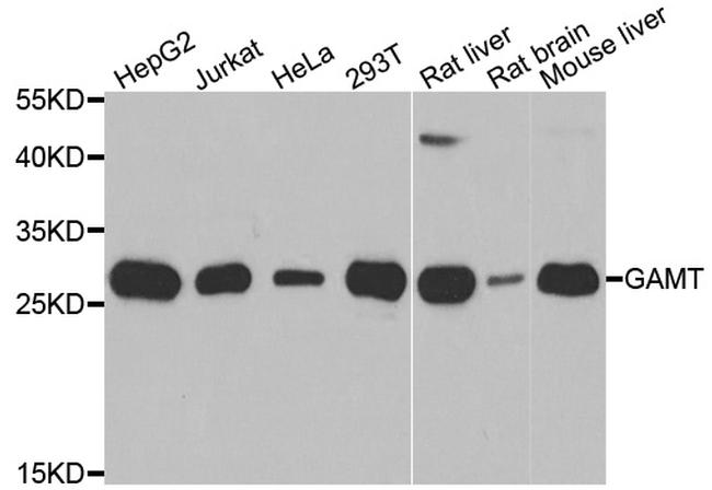 GAMT Antibody in Western Blot (WB)