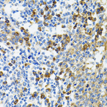 HYOU1 Antibody in Immunohistochemistry (Paraffin) (IHC (P))