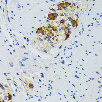 HYOU1 Antibody in Immunohistochemistry (Paraffin) (IHC (P))