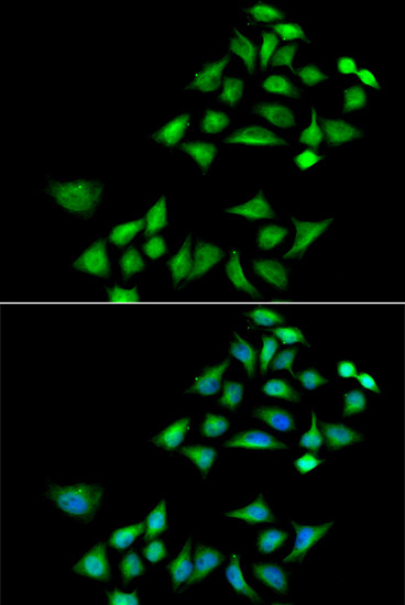 Kallikrein 4 Antibody in Immunocytochemistry (ICC/IF)